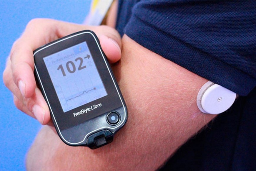 IPROSS | ATE logra un nuevo dispositivo para diabéticos  